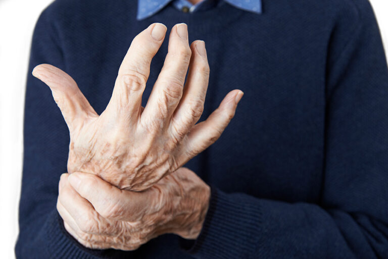 Home care can help seniors with chronic conditions like arthritis age in place safely.