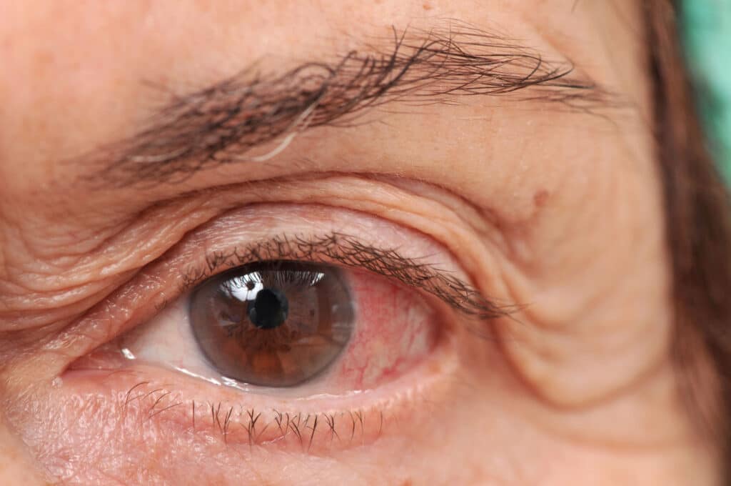 Senior home care supports vision health and independence for seniors